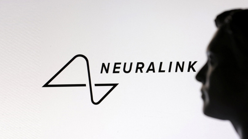 Gondolatot olvasna Elon Musk új Neuralink chipje