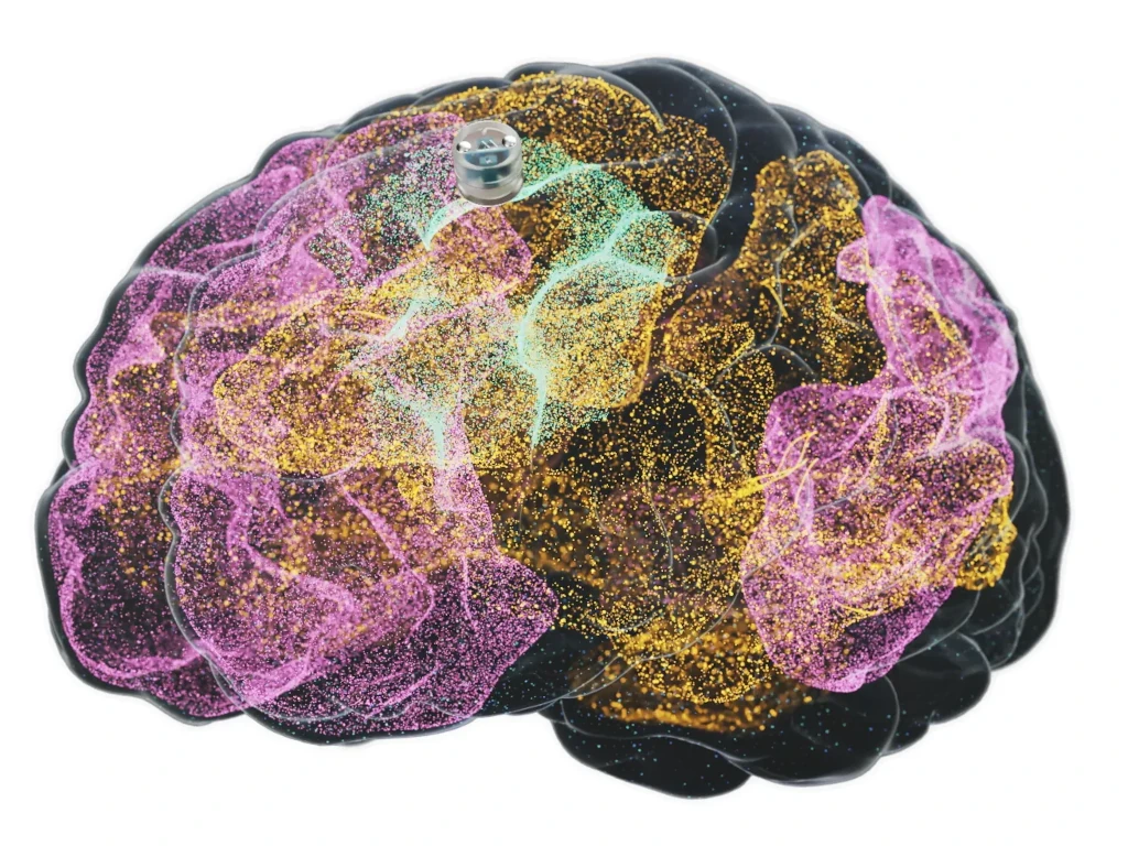 Ott van a Neuralink – és ott van a gondolatolvasó cég, amely talán felülmúlja azt